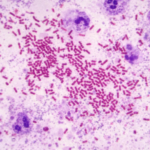 microscopic image of brucella