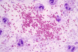 microscopic image of brucella