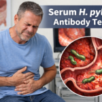 Serum H pylori antibody test blood sample in laboratory