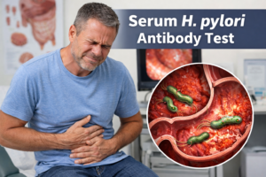 Serum H pylori antibody test blood sample in laboratory