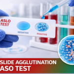 Discover everything about the ASlo test and treatment options for elevated antistreptolysin O levels. Expert guide with 7 key facts.