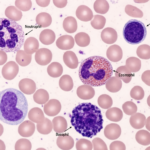 Leukocytes: 5 Essential Facts, Your Body’s Powerful Defense System