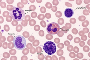 Leukocytes: 5 Essential Facts, Your Body’s Powerful Defense System